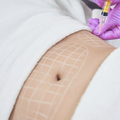 Masoterapia Abdominal
