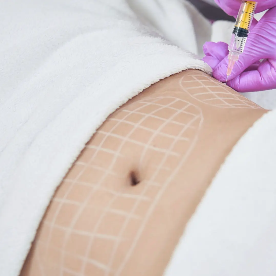 Masoterapia Abdominal