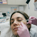 Polinucleótidos en ojeras